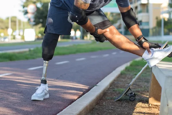 Prosthetics